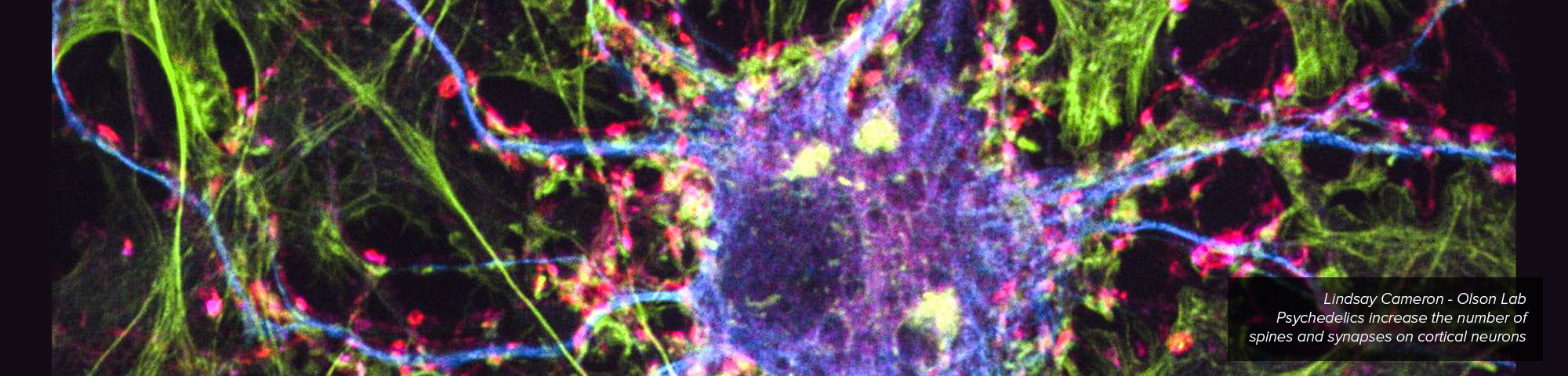 Fluorescent labeled neuronal cell