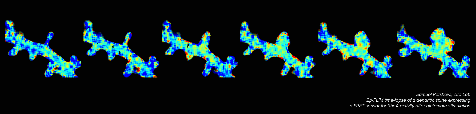 Series of dendritic spines