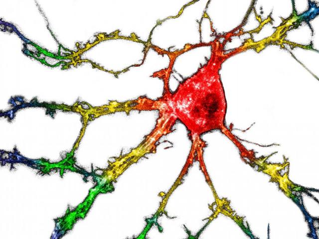 Calvin neuron