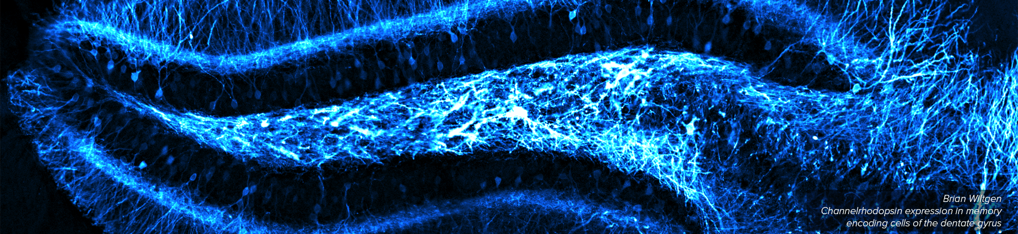 Fluorescent hippocampal section