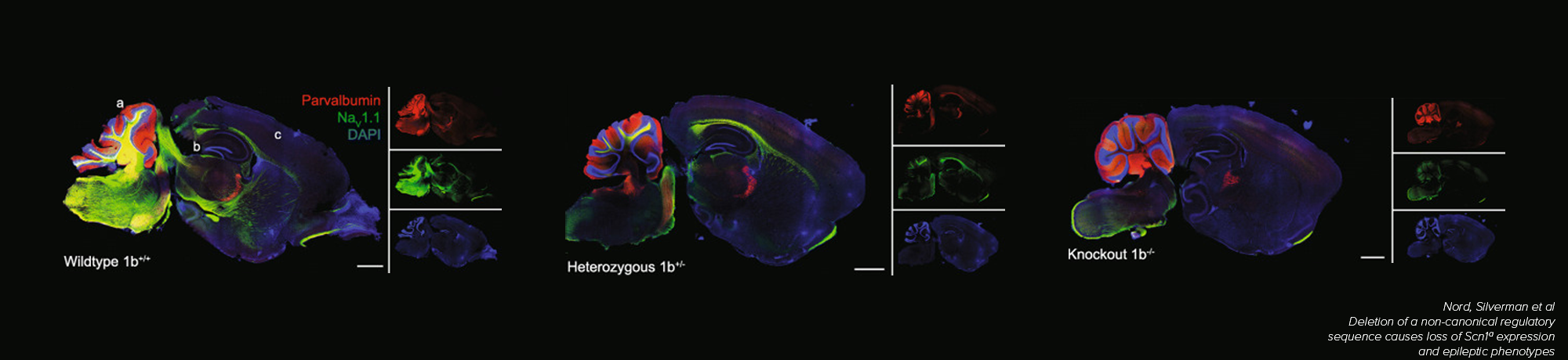 Fluorescently labeled brain sections